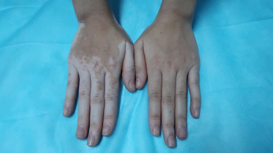lá trầu không ảnh 2 la trau khong anh 2