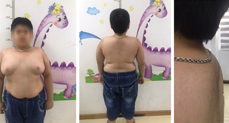 lam dung corticoid anh 1