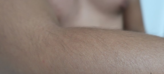 sữa trộn corticoid  ảnh 1 sua tron corticoid anh 1