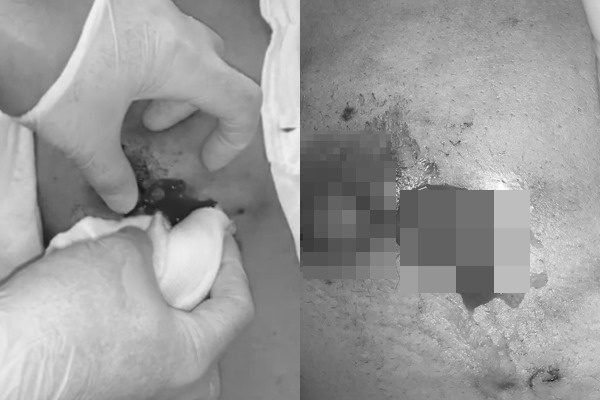 ruoc hoa vi di tham my anh 2