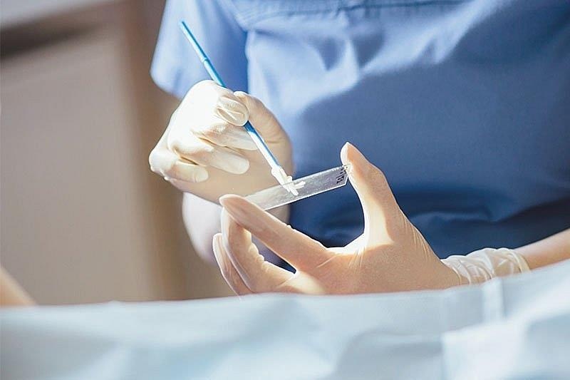 Giai phap nao giup tang co hoi song cho benh nhan ung thu? hinh anh