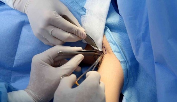 nguyen nhan gay hoi nach anh 6