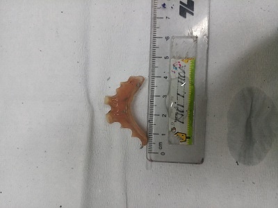 Uong thuoc, phu nu 53 tuoi nuot rang gia hinh anh