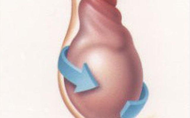 xoắn tinh hoàn ảnh 1 xoan tinh hoan anh 1