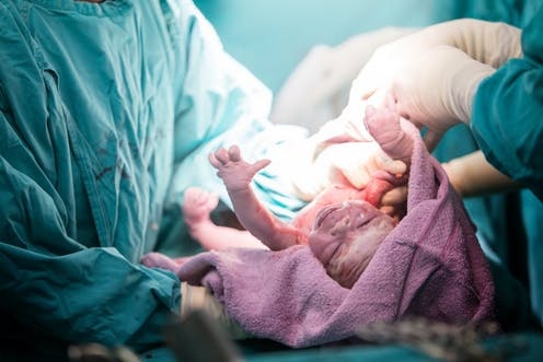 Thủ phạm khiến vùng kín xuống cấp ảnh 1 Thu pham khien vung kin xuong cap anh 1