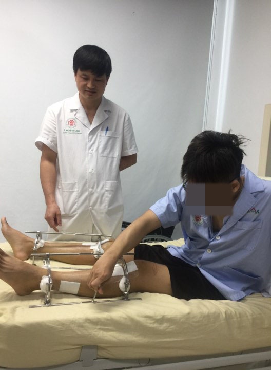 phau thuat keo dai chan anh 1