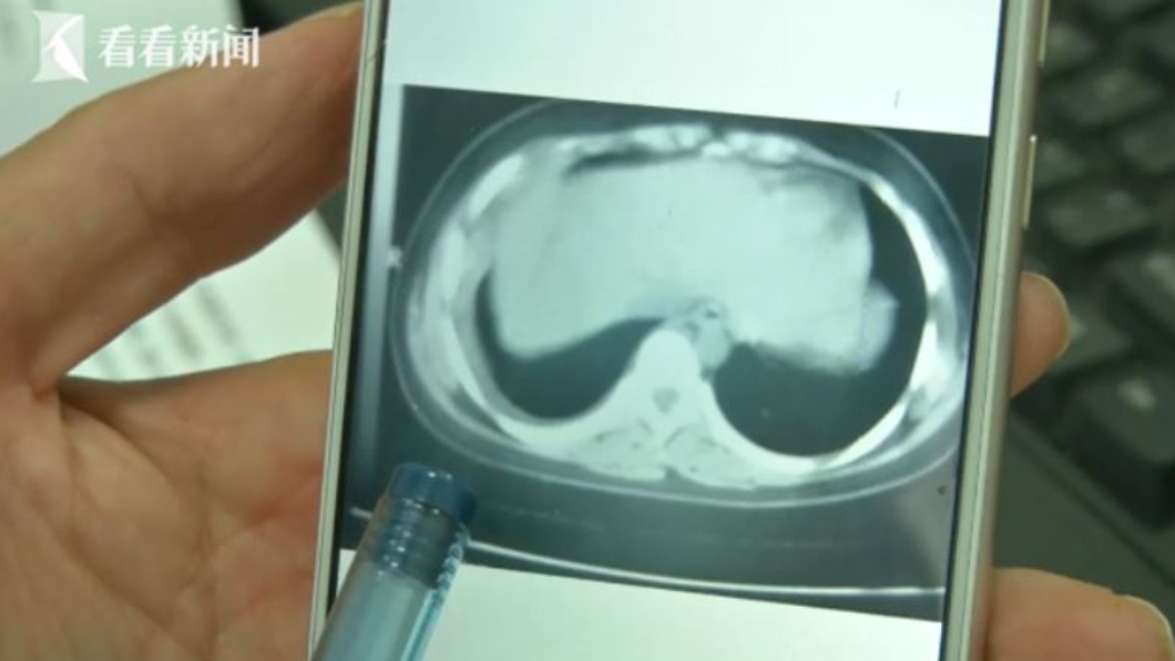 San an thung phoi anh 1