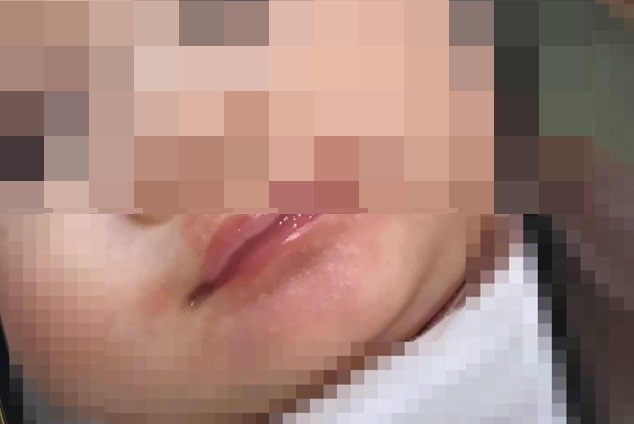 Be gai 3 thang nguy kich sau khi uong sua non Han Quoc hinh anh