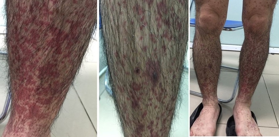 Di ung hai san anh 1