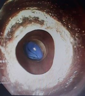 vien bi mac tai thuc quan be trai anh 1