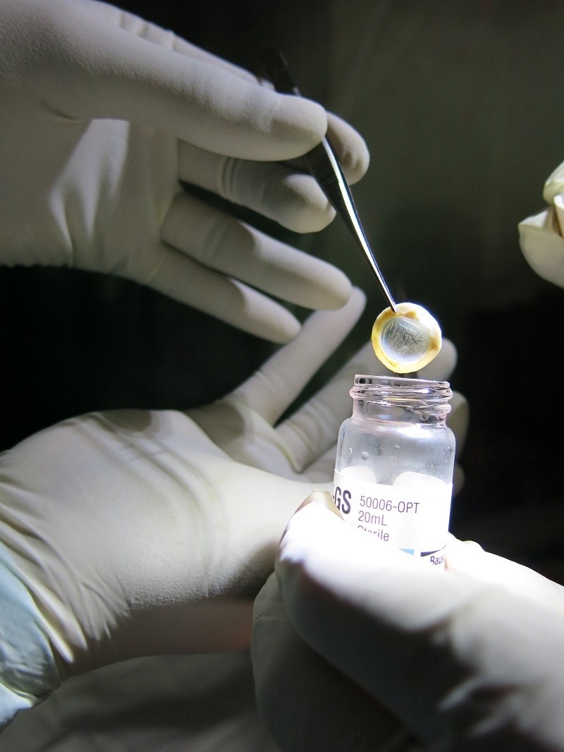 giac mac tu nguoi da khuat anh 2