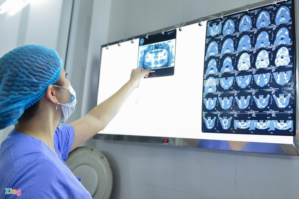 ung thu vung ham mat anh 1