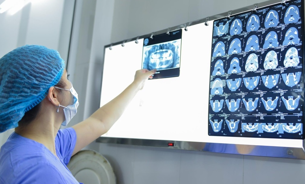 Phuong phap co the dieu tri khoi benh ung thu vung ham mat hinh anh