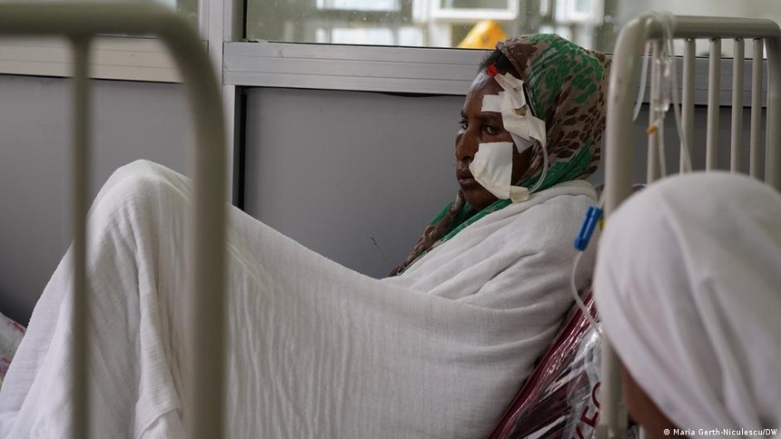 tong giam doc who anh 2