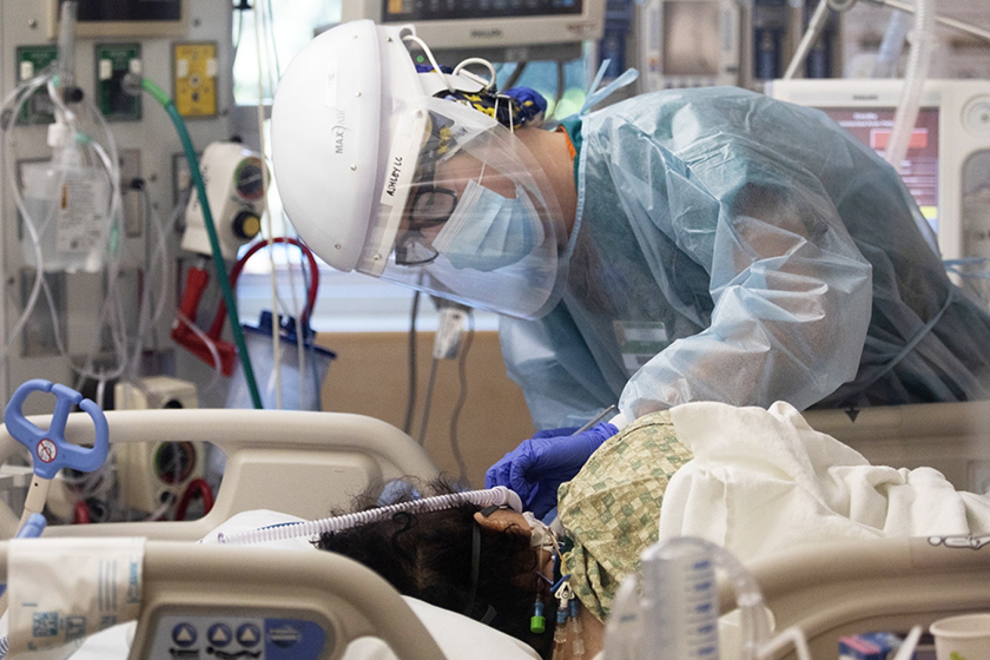 Nguy co tai mac Covid-19 sau 16 thang neu khong tiem vaccine hinh anh