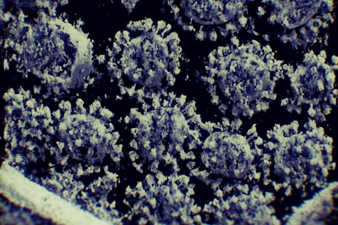 Phat hien moi ve F0 co nguy co mac benh nang va tu vong cao hinh anh