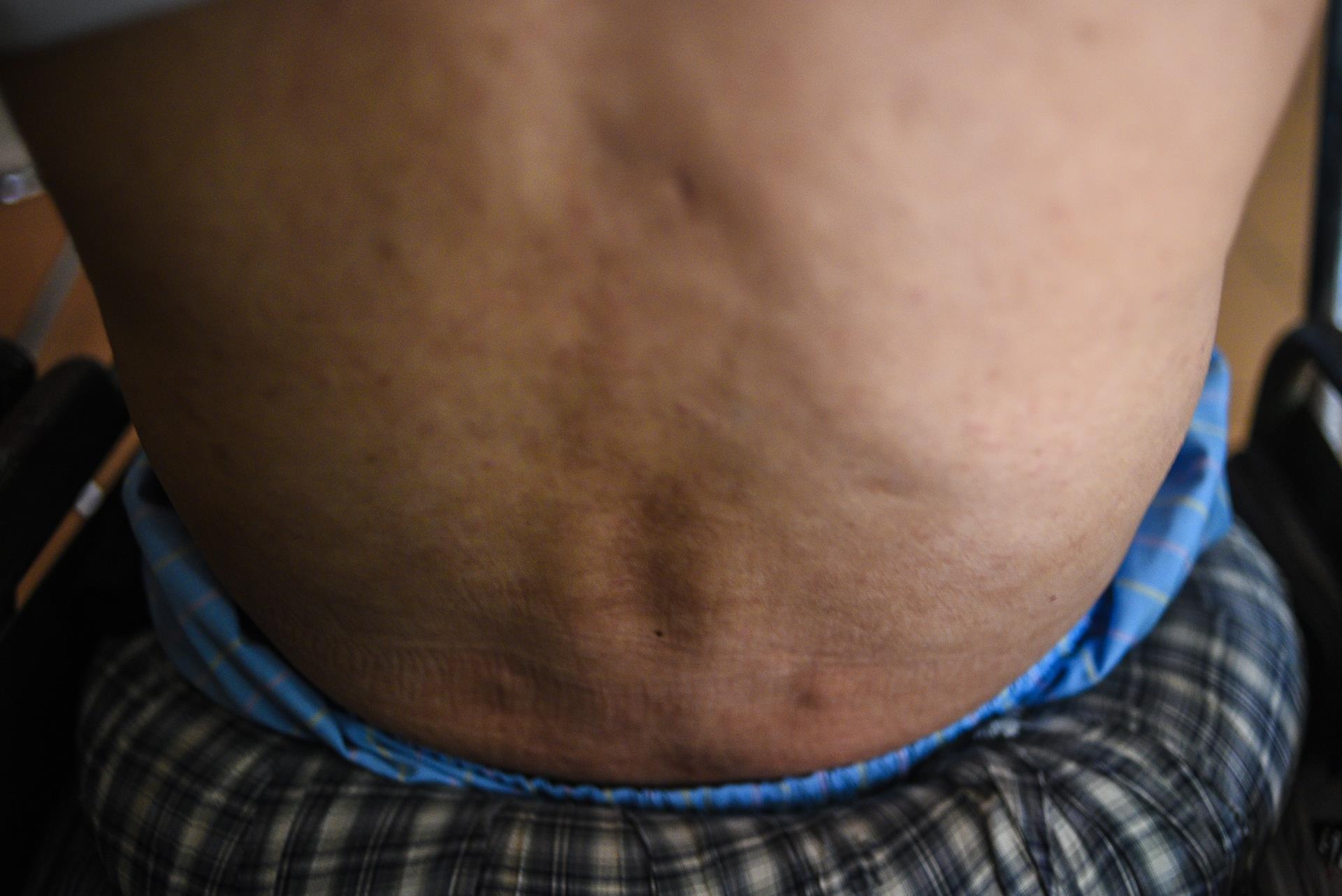 những người lính thương binh trên mặt trận ảnh 20 nhung nguoi linh thuong binh tren mat tran anh 20