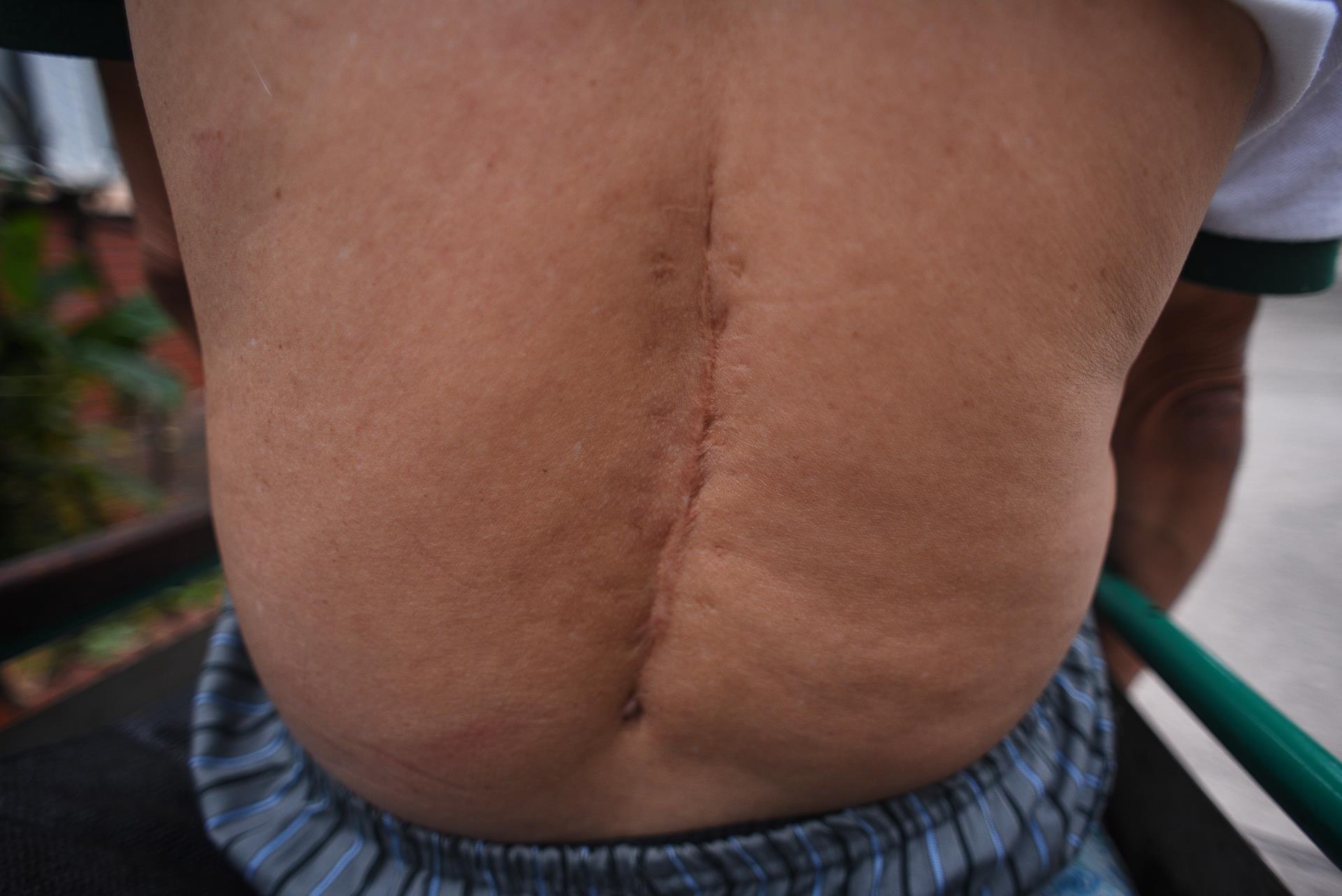 những người lính thương binh trên mặt trận ảnh 21 nhung nguoi linh thuong binh tren mat tran anh 21