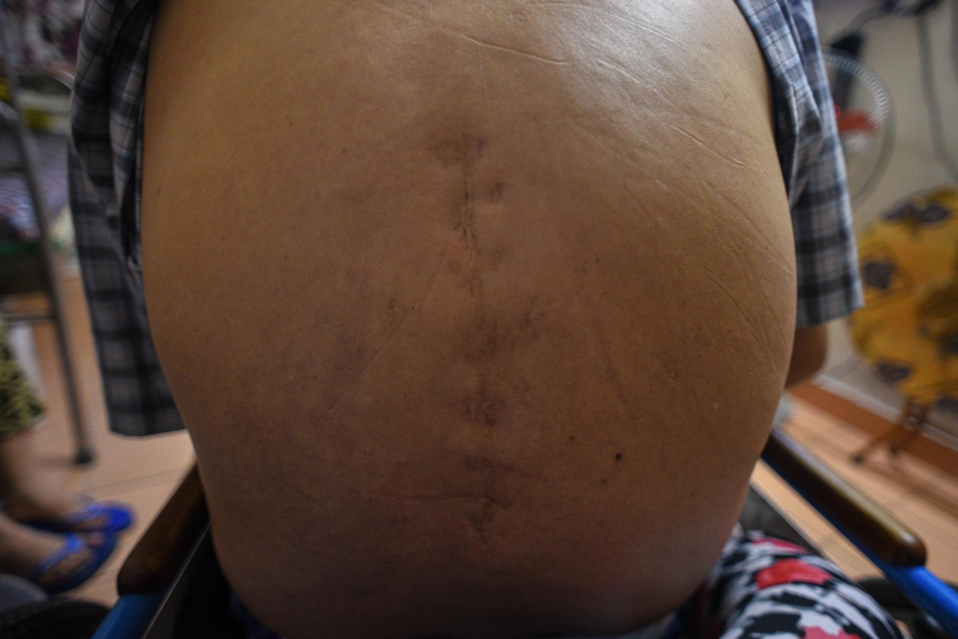 những người lính thương binh trên mặt trận ảnh 15 nhung nguoi linh thuong binh tren mat tran anh 15