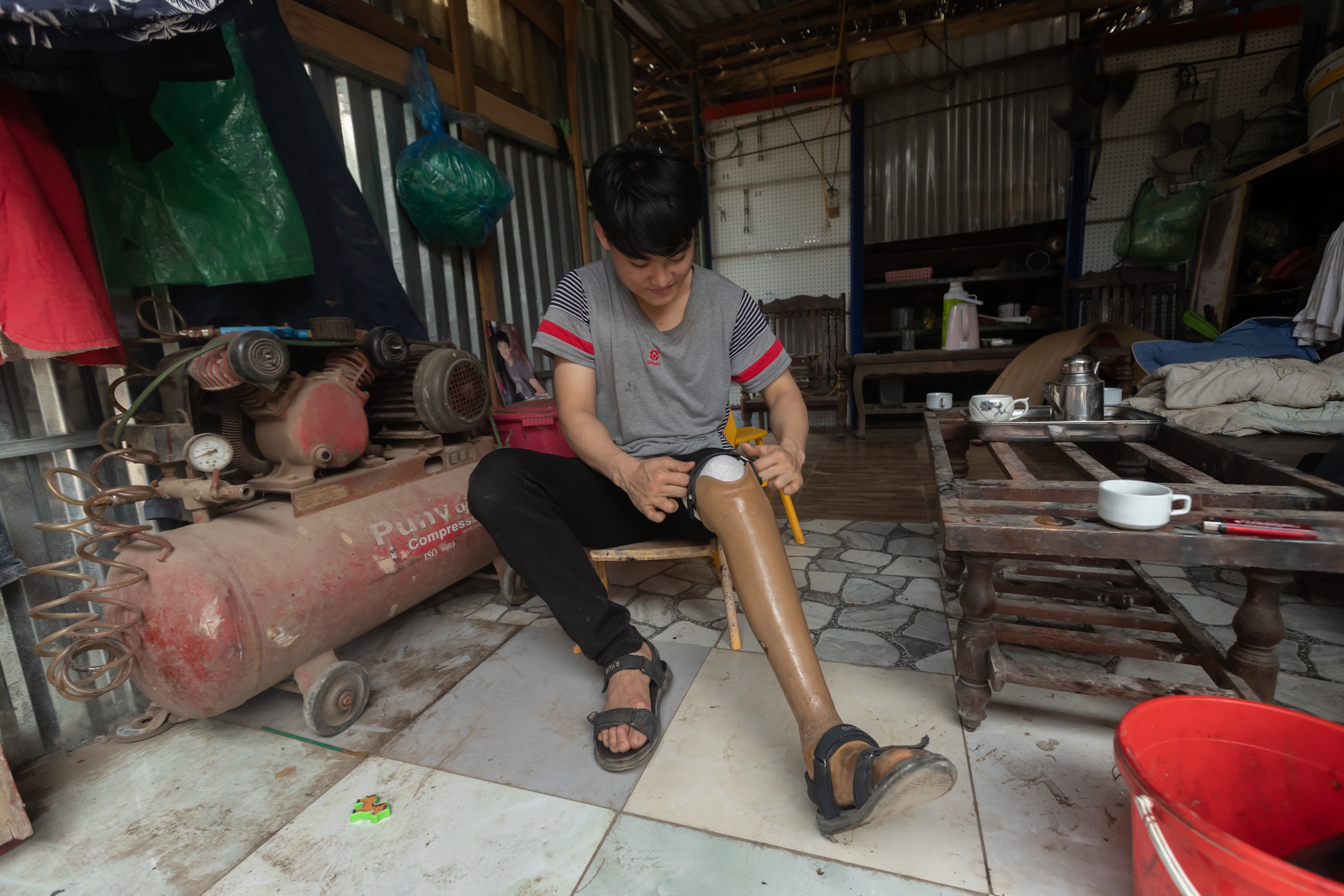 chang trai voi doi chan gia anh 3