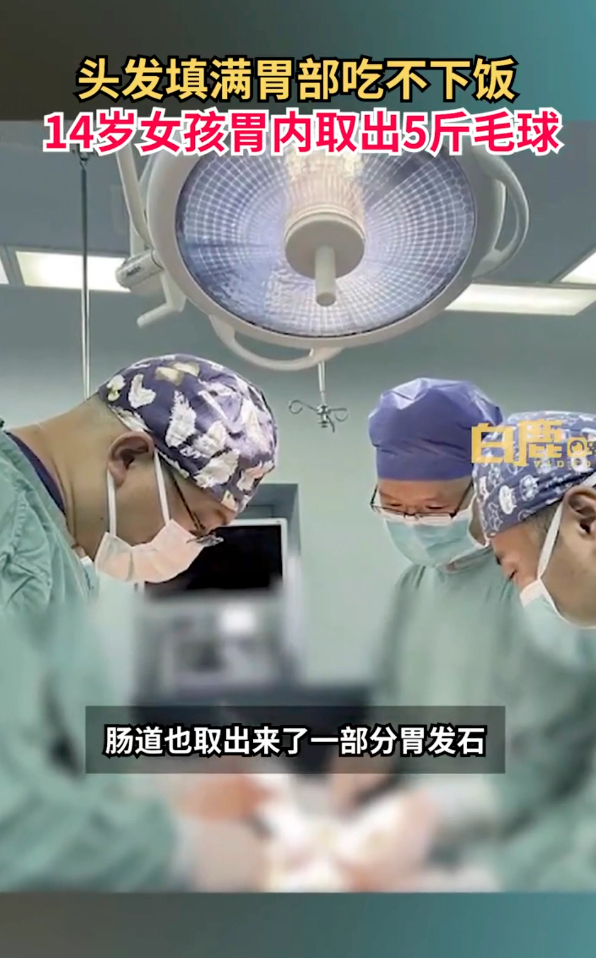 tóc ảnh 1 toc anh 1
