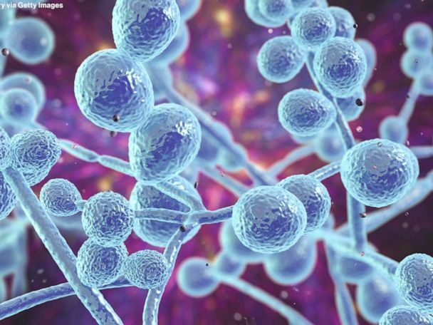 Viem mang nao do nam bung phat tai phong kham tham my o Mexico hinh anh