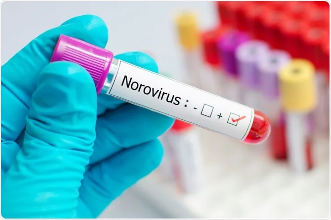 Norovirus ảnh 1 Norovirus anh 1