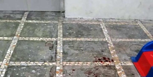 Be 3 tuoi bi da roi trung dau tu vong khi choi duoi san chung cu hinh anh