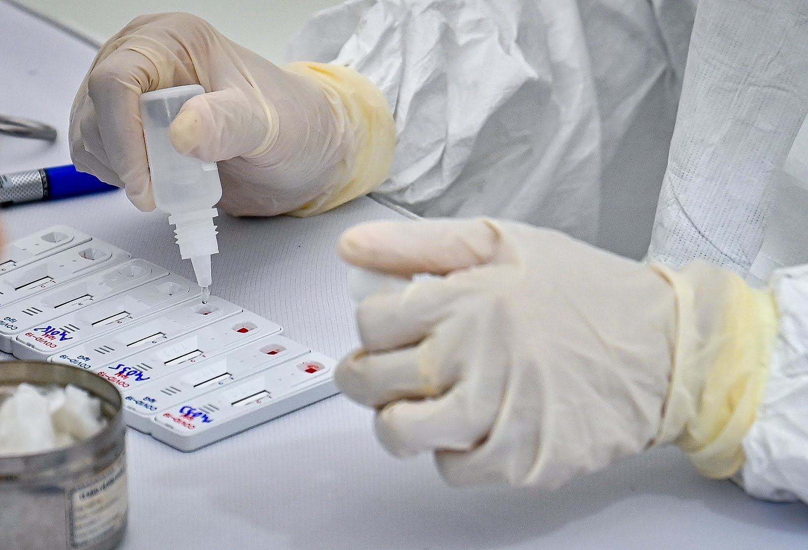 Ha Noi xet nghiem SARS-CoV-2 tren 100 mau thuc pham nhap khau hinh anh