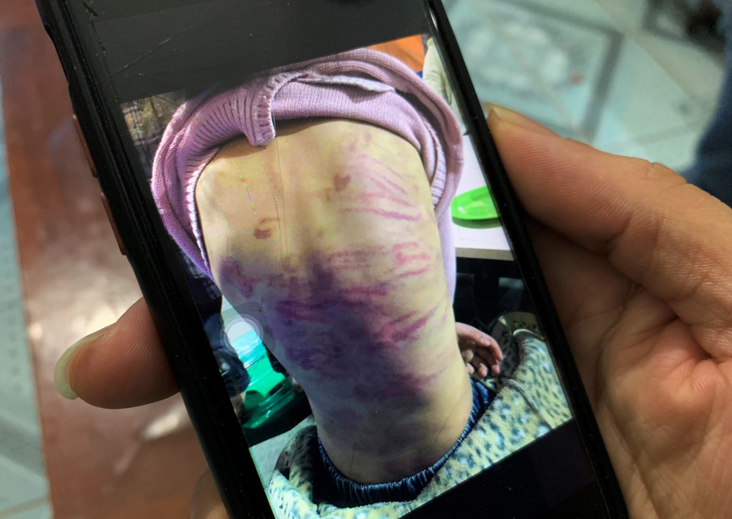Ha Noi yeu cau dieu tra vu be gai 12 tuoi bi me bao hanh hinh anh