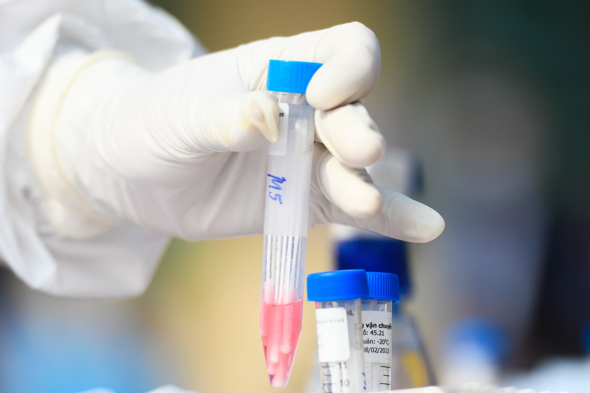 Ha Noi chuan bi xet nghiem cho 300.000 nguoi nguy co cao hinh anh