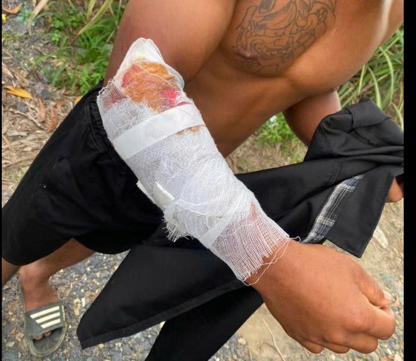 Nam thanh nien o Khanh Hoa bi ca sau tan cong khi di cau ca hinh anh