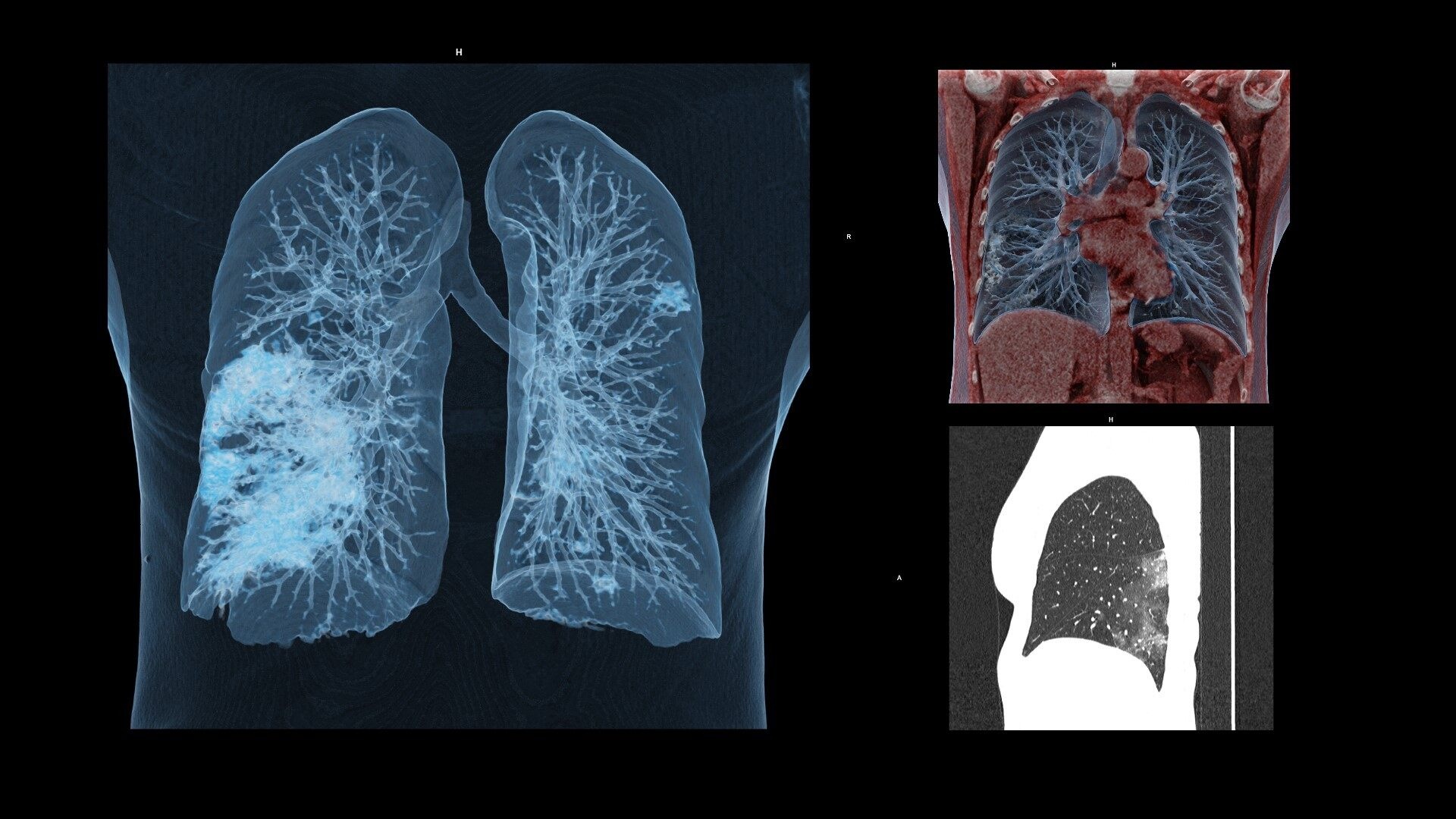 cau chuyen giai cap brazil mua dich anh 9