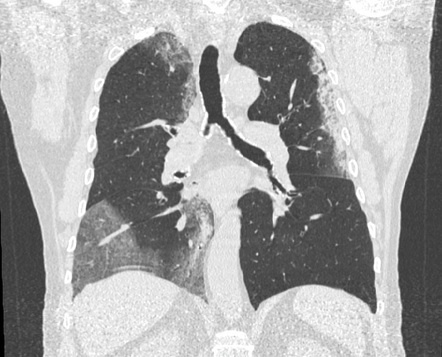 cau chuyen giai cap brazil mua dich anh 11