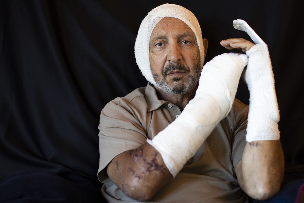 anh chup vet thuong nan nhan beirut anh 4