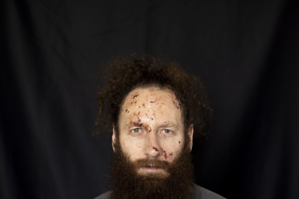 anh chup vet thuong nan nhan beirut anh 6