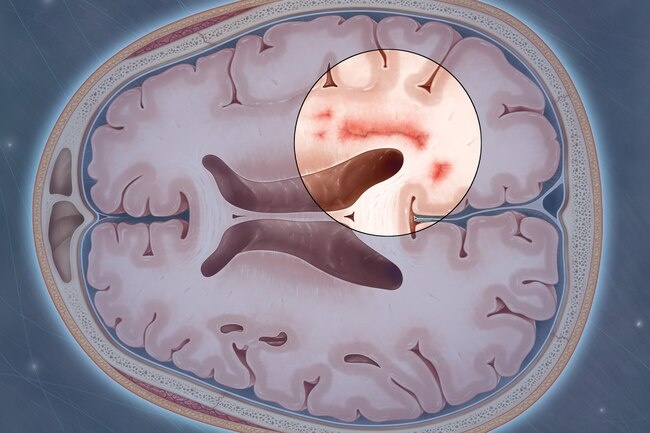 di chung tren nao benh nhan Covid-19 anh 5
