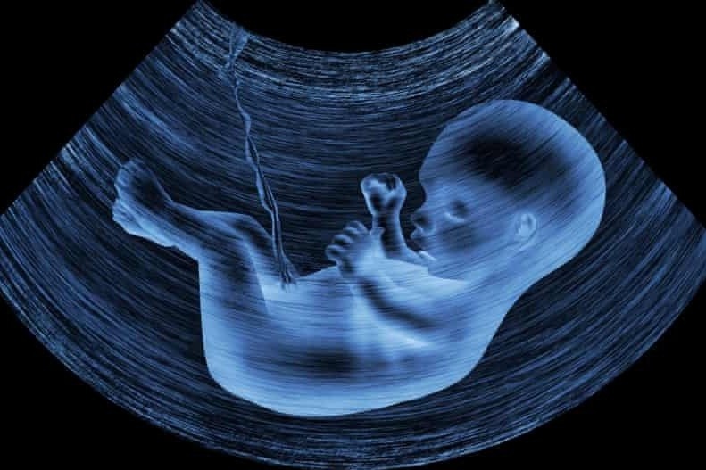 Phat hien hat vi nhua tren nhau thai o nguoi hinh anh