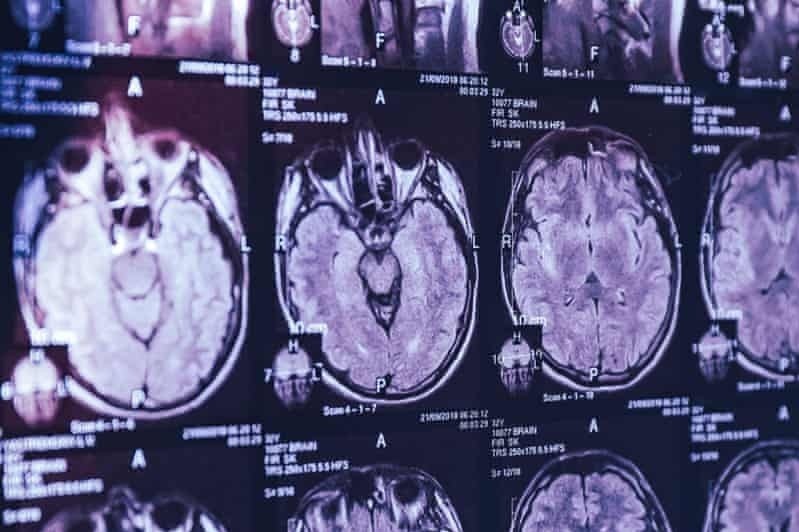 Hang loat nguoi o Canada mac benh la ve than kinh hinh anh