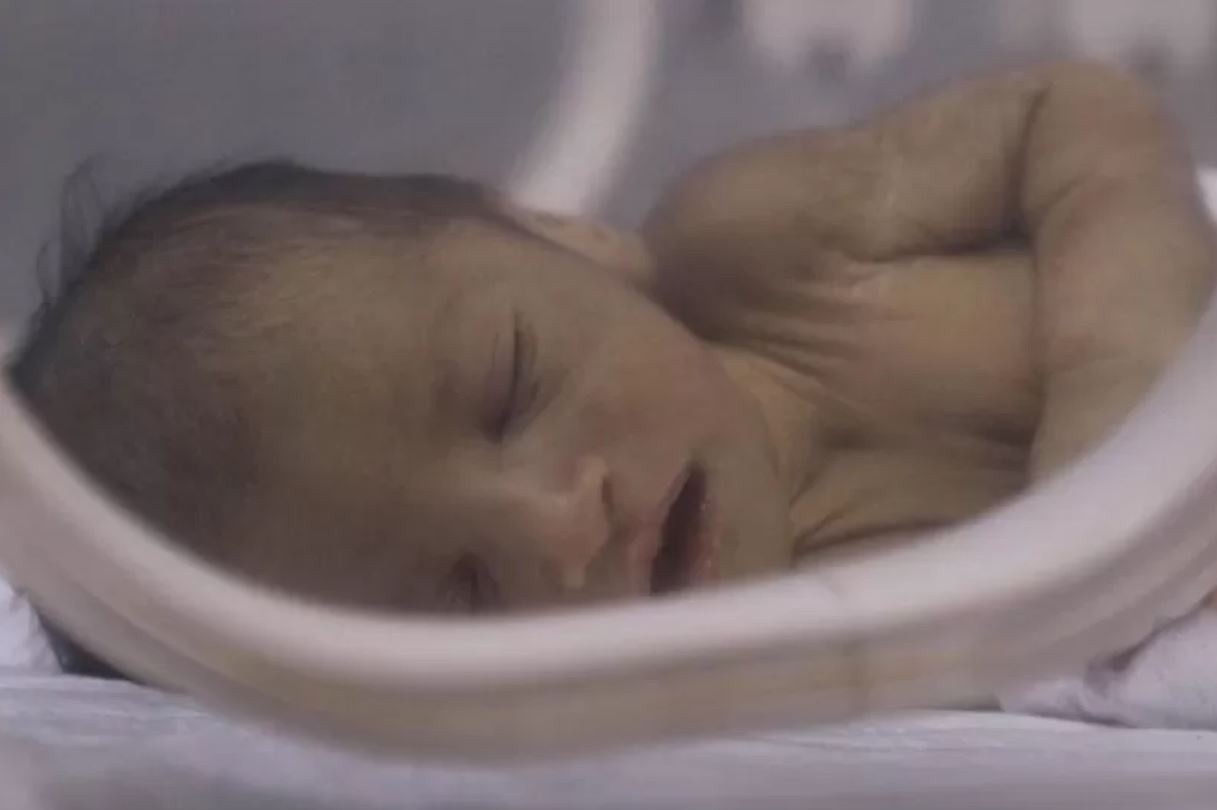 Phep mau kep o Syria sau dong dat huy diet hinh anh