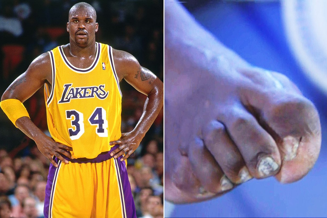 Cau thu bong ro bien dang ngon chan anh 5