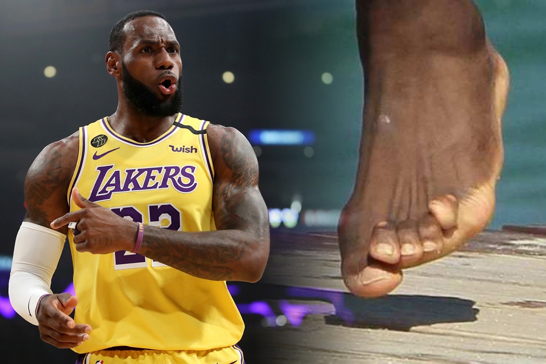 Ngon chan bien dang cua cac VDV bong ro hinh anh