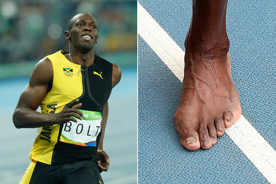 VDV the thao bien dang bo phan co the anh 1