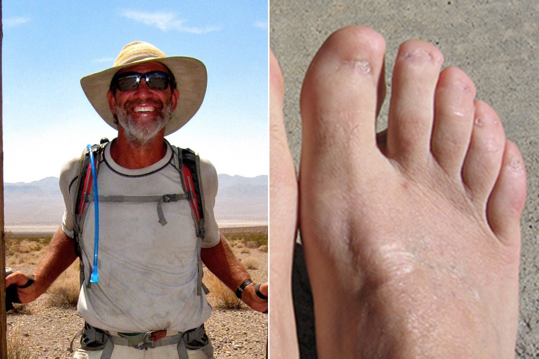 VDV the thao bien dang bo phan co the anh 6