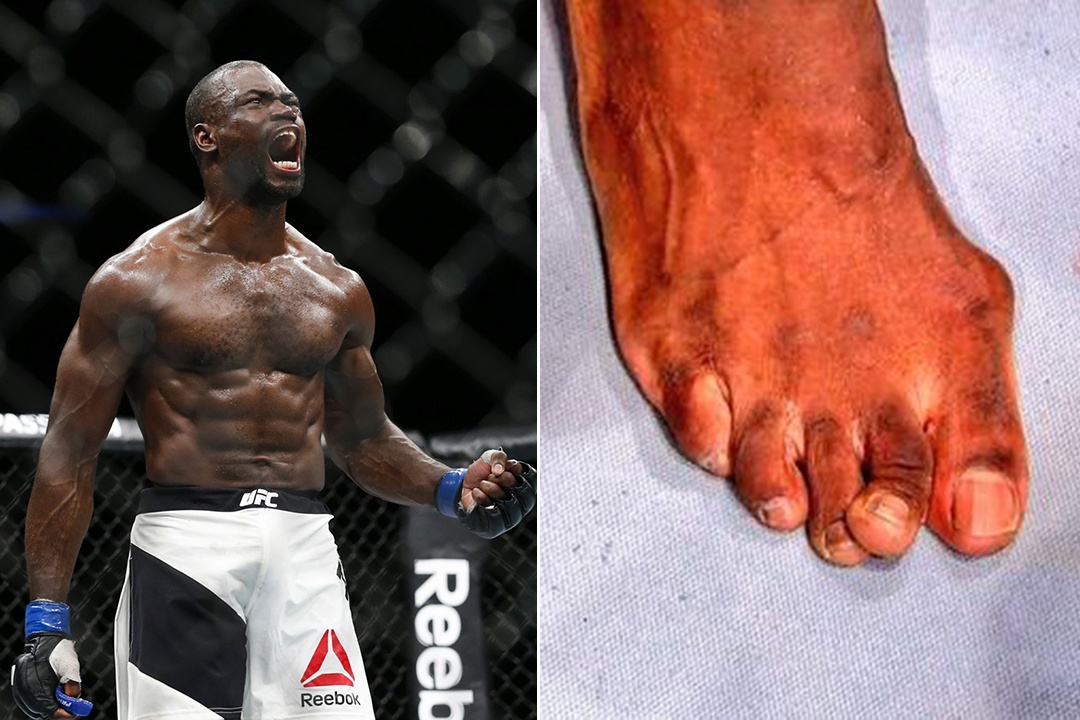 VDV the thao bien dang bo phan co the anh 4