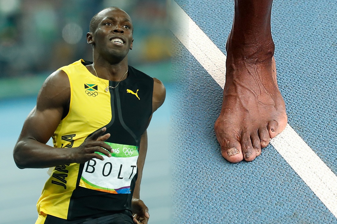 Nhung bo phan co the bien dang cua cac VDV the thao hinh anh