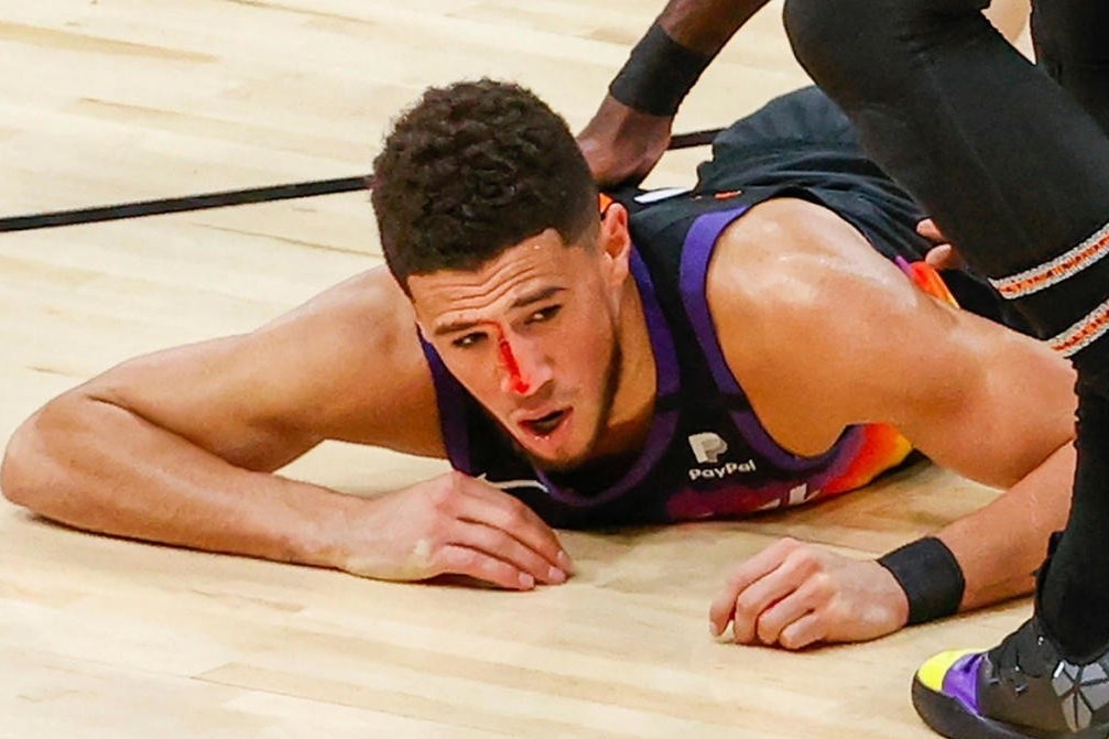 VDV bong ro bien dang mui vi va cham voi dong nghiep hinh anh