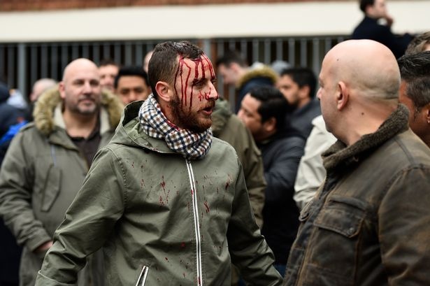 cổ động viên arsenal tottenham đánh nhau ảnh 5 co dong vien arsenal tottenham danh nhau anh 5