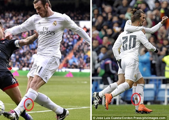 biện pháp chữa chấn thương của Bale ảnh 1 bien phap chua chan thuong cua Bale anh 1