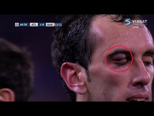 tran Barcelona vs Atletico anh 1